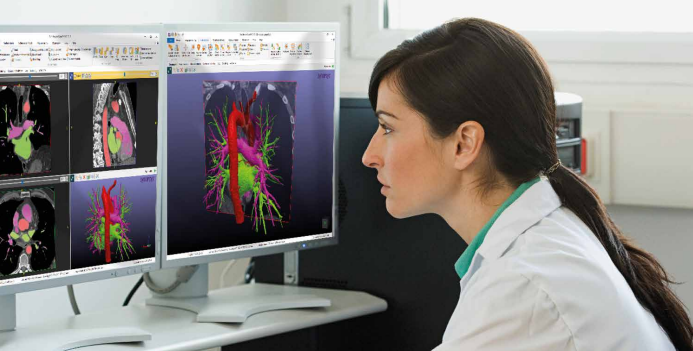 Simpleware Medical_6.png